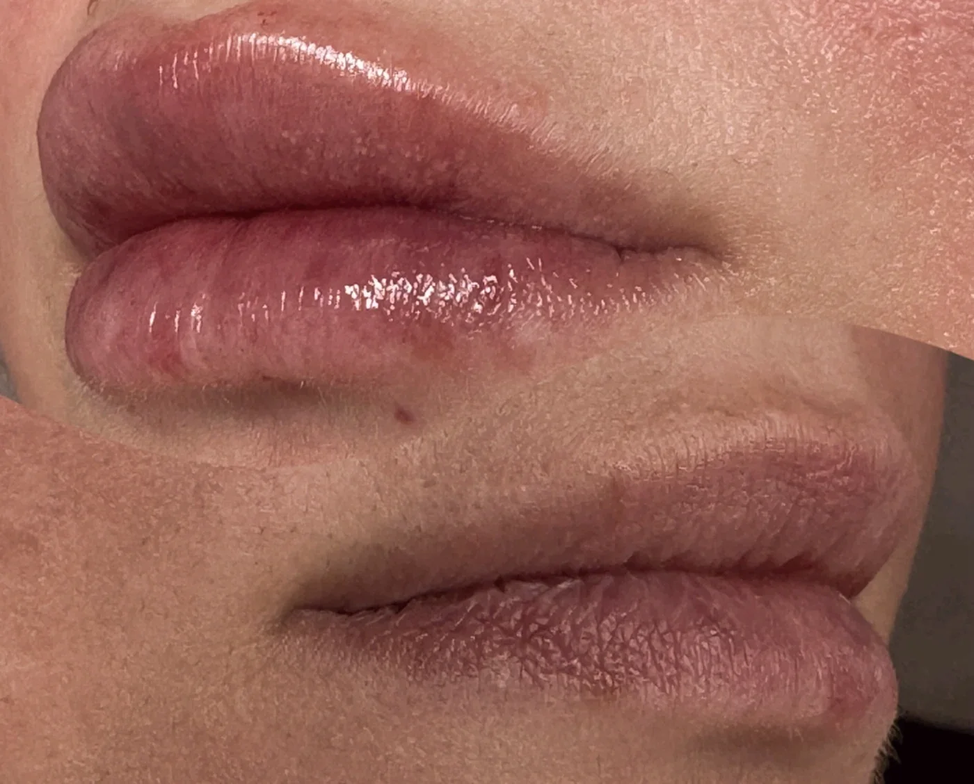 Trabajo de labio realizado en consulta