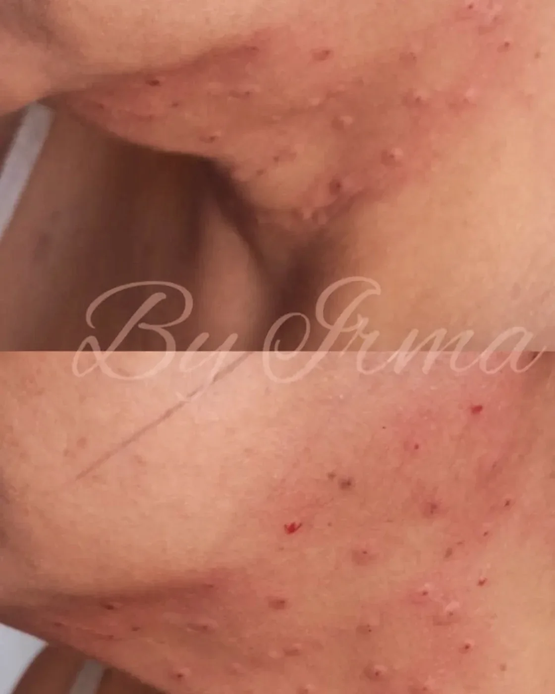 Piel del rostro tras una sesión de tratamiento facial