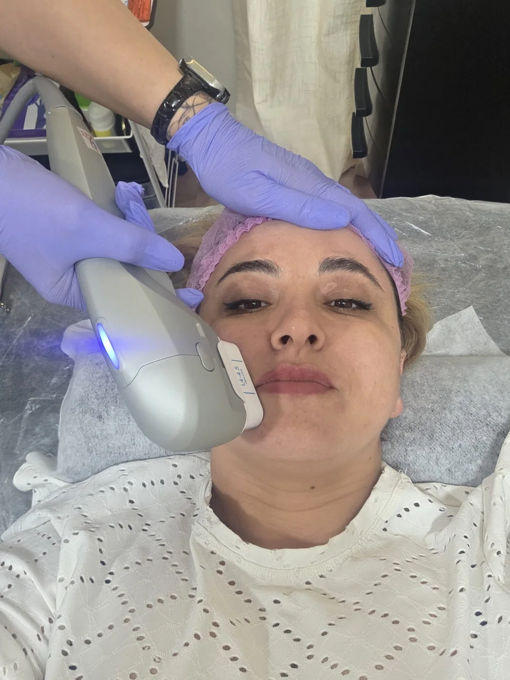 Cabezal de aparatología facial sobre la mandíbula de una clienta